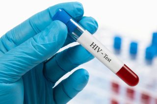 hiv test